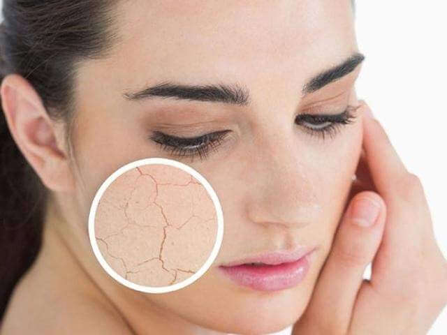 Summer Skin Problems? Here are Simple Solutions